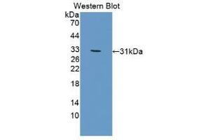 Detection of recombinant BMX using Polyclonal Antibody to BMX Non Receptor Tyrosine Kinase (BMX) (BMX anticorps  (AA 209-446))