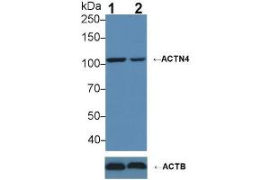Knockout Varification: ;Lane 1: Wild-type MCF7 cell lysate; ;Lane 2: ACTN4 knockout MCF7 cell lysate; ;Predicted MW: 104,79,59kDa ;Observed MW: 104kDa;Primary Ab: 3µg/ml Rabbit Anti-Human ACTN4 Antibody;Second Ab: 0.