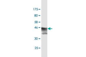 Western Blot detection against Immunogen (47.
