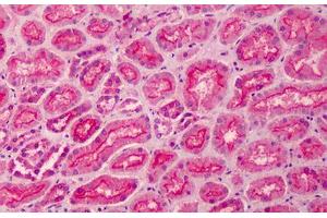 Human Kidney: Formalin-Fixed, Paraffin-Embedded (FFPE) (MPP5 anticorps  (AA 174-187))
