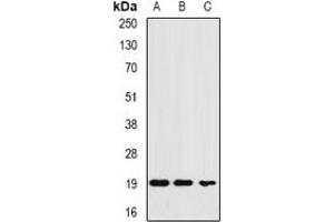 Western blot analysis of Ferritin L expression in HEK293T (A), MCF7 (B), HepG2 (C) whole cell lysates. (Ferritin L anticorps)