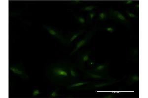 Immunofluorescence of monoclonal antibody to ESR1 on HeLa cell. (Estrogen Receptor alpha anticorps  (AA 41-140))