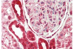 Rabbit Anti-EIF4H antibody  Formalin Fixed Paraffin Embedded Tissue: Human Kidney Primary antibody Concentration: 1:200 Secondary Antibody: Donkey anti-Rabbit-Cy3 Secondary Antibody Concentration: 1:200 Magnification: 20x Exposure Time: 0.