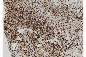ABIN6272905 at 1/100 staining Human spleen tissue by IHC-P. (RBM15 anticorps  (N-Term))
