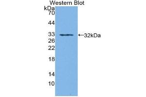 Western Blotting (WB) image for anti-Sorbitol Dehydrogenase (SORD) (AA 98-355) antibody (ABIN1870684) (SORD anticorps  (AA 98-355))
