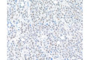 Immunohistochemistry (IHC) image for anti-Bromodomain Containing 9 (BRD9) (AA 547-597) antibody (ABIN7455162) (Recombinant BRD9 anticorps  (AA 547-597))