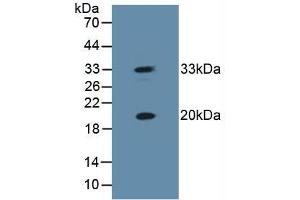 Western blot analysis of Mouse Skeletal Muscle Tissue. (HSPB2 anticorps  (AA 12-182))