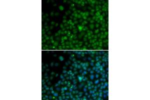 Immunofluorescence analysis of U20S cell using IRF4 antibody. (IRF4 anticorps  (AA 180-451))