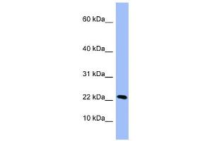 PIN4 antibody used at 1 ug/ml to detect target protein. (PIN4 anticorps  (Middle Region))