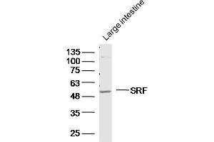 Mouse large intestine lysates probed with Polyclonal Antibody, unconjugated  at 1:300 overnight at 4°C followed by a conjugated secondary antibody at 1:10000 for 90 minutes at 37°C.