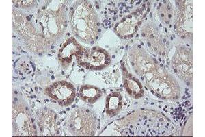 Image no. 1 for anti-RAB21, Member RAS Oncogene Family (RAB21) antibody (ABIN1500541)