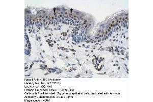 Rabbit Anti-GTF21 Antibody  Paraffin Embedded Tissue: Human Skin Cellular Data: Squamous epithelial cells Antibody Concentration: 4. (GTF2I anticorps  (N-Term))