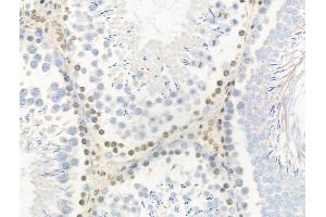 Phospho-AurB/C (Thr236/Thr202) Antibody at 1/100 staining Rat testis tissue by IHC-P. (AurB/C anticorps  (pThr202, pThr236))