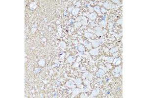 Immunohistochemistry of paraffin-embedded rat brain using V antibody (ABIN3021846, ABIN3021847, ABIN1513674 and ABIN6216136) at dilution of 1:100 (40x lens). (VAMP2 anticorps  (AA 1-100))