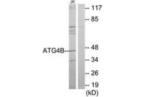 Western blot analysis of extracts from Jurkat cells, using ATG4B Antibody.