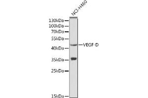 Western blot analysis of extracts of NCI-H460 cells, using VEGFD antibody (ABIN3021685, ABIN3021686, ABIN3021687 and ABIN6215506) at 1:1000 dilution. (VEGFD anticorps  (AA 20-220))