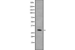 Western blot analysis of hnRNP A0 using COLO205 whole cell lysates (HNRNPA0 anticorps  (Internal Region))