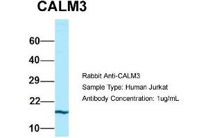 Host: Rabbit  Target Name: CALM3  Sample Tissue: Human Jurkat  Antibody Dilution: 1. (Calmodulin 3 anticorps  (N-Term))