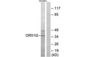 Western blot analysis of extracts from HuvEc cells, using OR51I2 Antibody. (OR51I2 anticorps  (AA 201-250))