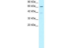 WB Suggested Anti-SKIIP Antibody Titration:  0. (SNW1 anticorps  (N-Term))