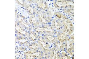 Immunohistochemistry of paraffin-embedded rat kidney using LRP2 antibody (ABIN5995557) at dilution of 1/100 (40x lens). (LRP2 anticorps)