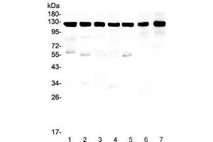 Western blot testing of Amyloid beta antibody and Lane 1:  rat brain (APP anticorps  (C-Term))