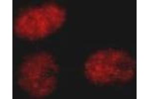 Immunofluorescence (IF) image for anti-SWI/SNF Related, Matrix Associated, Actin Dependent Regulator of Chromatin, Subfamily A, Member 4 (SMARCA4) (C-Term) antibody (ABIN2451926) (SMARCA4 anticorps  (C-Term))