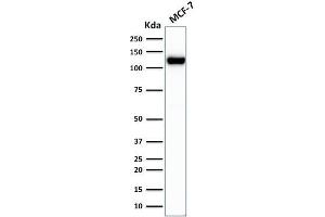 Western Blot Analysis of MCF-7 cell lysate using E-Cadherin Mouse Recombinant Monoclonal Antibody (rCDH1/1525).