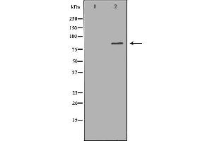 Western blot analysis of Jurkat whole cell lysates, using HADHA Antibody. (HADHA anticorps  (C-Term))