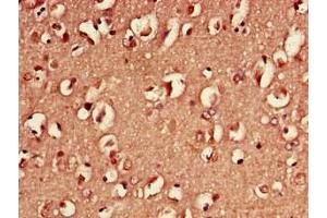 Immunohistochemistry of paraffin-embedded human brain tissue using ABIN7142092 at dilution of 1:100