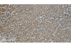 IHC analysis of U2AF65/U2AF2 using anti U2AF65/U2AF2 antibody (ABIN7600794). (U2AF2 anticorps  (AA 238-470))