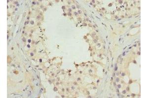 Immunohistochemistry of paraffin-embedded human testis tissue using ABIN7174649 at dilution of 1:100 (UGT3A2 anticorps  (AA 23-300))