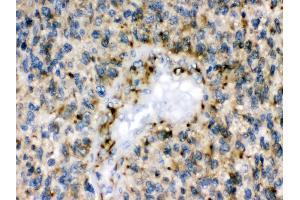 Anti- Eph receptor B1 Picoband antibody, IHC(P) IHC(P): Human Glioma Tissue