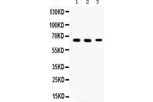 Western blot analysis of Alpha Internexin expression in rat brain extract ( Lane 1), mouse brain extract ( Lane 2) and 22RV1 whole cell lysates ( Lane 3). (INA anticorps  (AA 71-161))