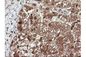 Image no. 2 for anti-Ubiquitin-Conjugating Enzyme E2G 2 (UBE2G2) antibody (ABIN1501634)