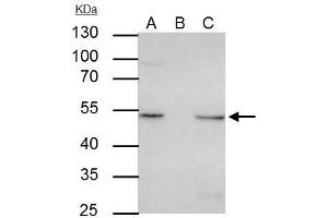 IP Image ILK antibody [N1C1] immunoprecipitates ILK protein in IP experiments.