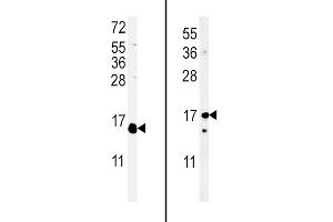(LEFT)Western blot analysis of IL4 Antibody (C-term) (ABIN651434 and ABIN2840238) in WiDr cell line lysates (35 μg/lane). (IL-4 anticorps  (C-Term))