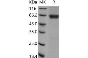 Western Blotting (WB) image for Casein Kinase 2 alpha 1 (CSNK2A1) (Active) protein (GST tag) (ABIN7317101)