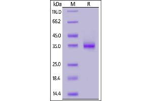SARS-CoV-2 S protein RBD (N501Y), His Tag on  under reducing (R) condition.