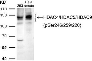 Western blot analysis of extracts from 293 cells and Hela cells treated with serum using HDAC4/HDAC5/HDAC9 (phospho-Ser246/259/220) Antibody. (HDAC4/HDAC5/HDAC9 anticorps  (pSer220, pSer246, pSer259))
