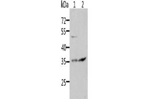 Western Blotting (WB) image for anti-Suppressor of Cytokine Signaling 1 (SOCS1) antibody (ABIN2431838) (SOCS1 anticorps)