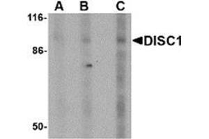Western blot analysis of DISC1 in SK-N-SH cell lysate with AP30292PU-N DISC1 antibody at (A) 0. (DISC1 anticorps  (Center))