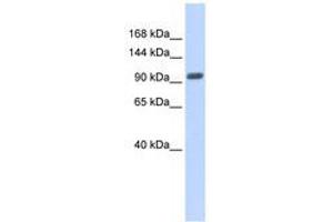 Image no. 1 for anti-Zinc Finger Protein 512B (ZNF512B) (AA 539-588) antibody (ABIN6740330) (ZNF512B anticorps  (AA 539-588))