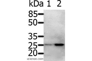 Western blot analysis of 231 cell and Human fetal brain tissue, using RAB5A Polyclonal Antibody at dilution of 1:600 (RAB5 anticorps)