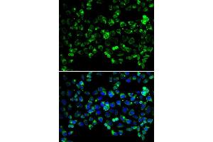 Immunofluorescence analysis of HeLa cells using PINK1 antibody (ABIN5998524). (PINK1 anticorps)