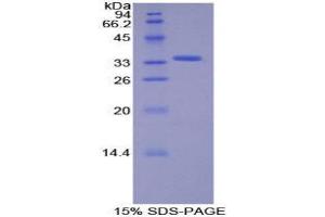 SDS-PAGE (SDS) image for Salt-Inducible Kinase 2 (SIK2) (AA 655-925) protein (His tag) (ABIN1877625)