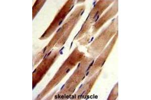 Immunohistochemistry (IHC) image for anti-Actin-Related Protein 2 (ACTR2) antibody (ABIN3002671) (ACTR2 anticorps)