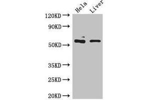 Western Blot Positive WB detected in: Hela whole cell lysate, Mouse liver tissue All lanes: KRT81 antibody at 5 μg/mL Secondary Goat polyclonal to rabbit IgG at 1/50000 dilution Predicted band size: 55 kDa Observed band size: 55 kDa (KRT81 anticorps  (AA 3-505))