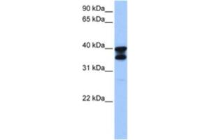 Western Blotting (WB) image for anti-Solute Carrier Family 25 (Mitochondrial Carrier, Adenine Nucleotide Translocator), Member 31 (SLC25A31) antibody (ABIN2463612)