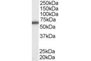 Western Blotting (WB) image for anti-DEAD (Asp-Glu-Ala-Asp) Box Polypeptide 5 (DDX5) (C-Term) antibody (ABIN2465593) (DDX5 anticorps  (C-Term))